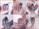 Pyrrhospora quernea image