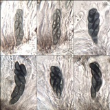 Buellia chloroleuca image
