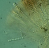 Pulvinula archeri image