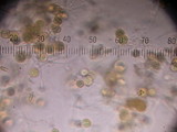 Hypomyces microspermus image