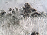 Buellia erubescens image