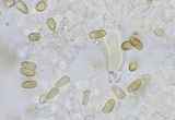 Inocybe lacera image
