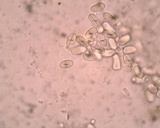 Pilobolus crystallinus image
