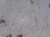 Schismatomma graphidioides image