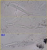 Schismatomma graphidioides image
