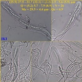 Schismatomma graphidioides image