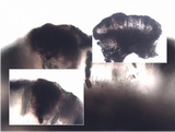 Laeviomyces pertusariicola image