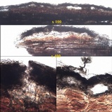 Arthopyrenia nitescens image