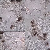 Collema polycarpon image