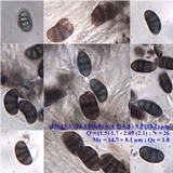 Diplotomma hedinii image