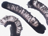 Diploschistes diacapsis image