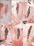 Diploschistes diacapsis image