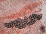 Diploschistes diacapsis image