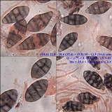 Diploschistes diacapsis image