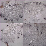 Bacidia laurocerasi image