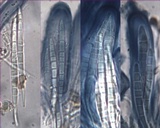 Bacidia laurocerasi image