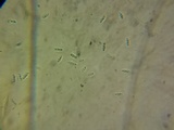 Bisporella sulfurina image