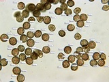 Reticularia jurana image