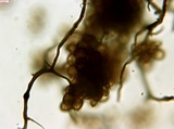 Reticularia jurana image