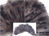 Diplotomma alboatrum image