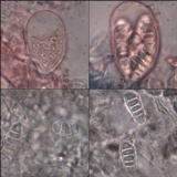 Arthonia pruinata image