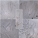 Enterographa hutchinsiae image