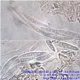 Enterographa hutchinsiae image