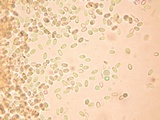Lysurus pakistanicus image