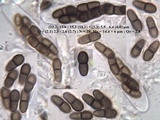 Abrothallus parmeliarum image