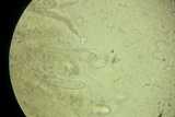 Amniculicola parva image