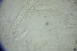 Amniculicola parva image