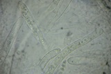 Amniculicola parva image