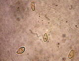 Tylopilus atronicotianus image