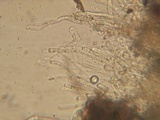 Neottiella albocincta image