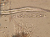 Neottiella albocincta image