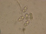 Neottiella albocincta image