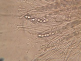 Neottiella albocincta image