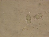 Neottiella albocincta image