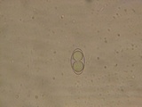 Neottiella albocincta image