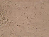 Neottiella albocincta image