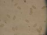 Inocybe arthrocystis image