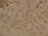 Inocybe arthrocystis image