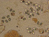 Ascobolus equinus image