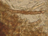 Wilcoxina rehmii image