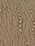 Wilcoxina rehmii image