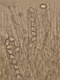 Wilcoxina rehmii image