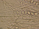 Wilcoxina rehmii image