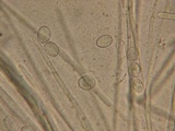 Wilcoxina rehmii image