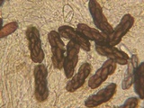 Saccobolus depauperatus image