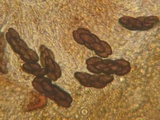 Saccobolus depauperatus image